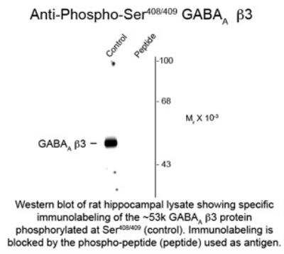 Western Blot: GABA-A R beta 3 [p Ser409, p Ser408] Antibody [NBP2-29508]